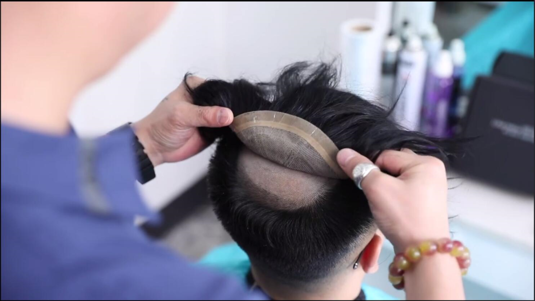 心理上还是会一直担心假发掉了怎么办