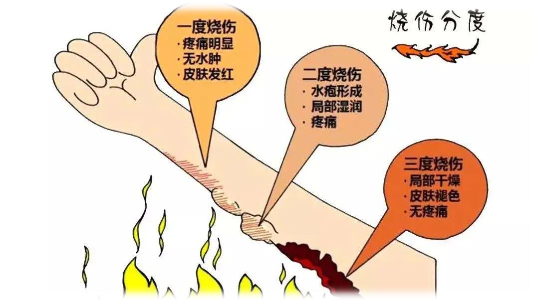 婴幼儿常见意外伤害急救措施