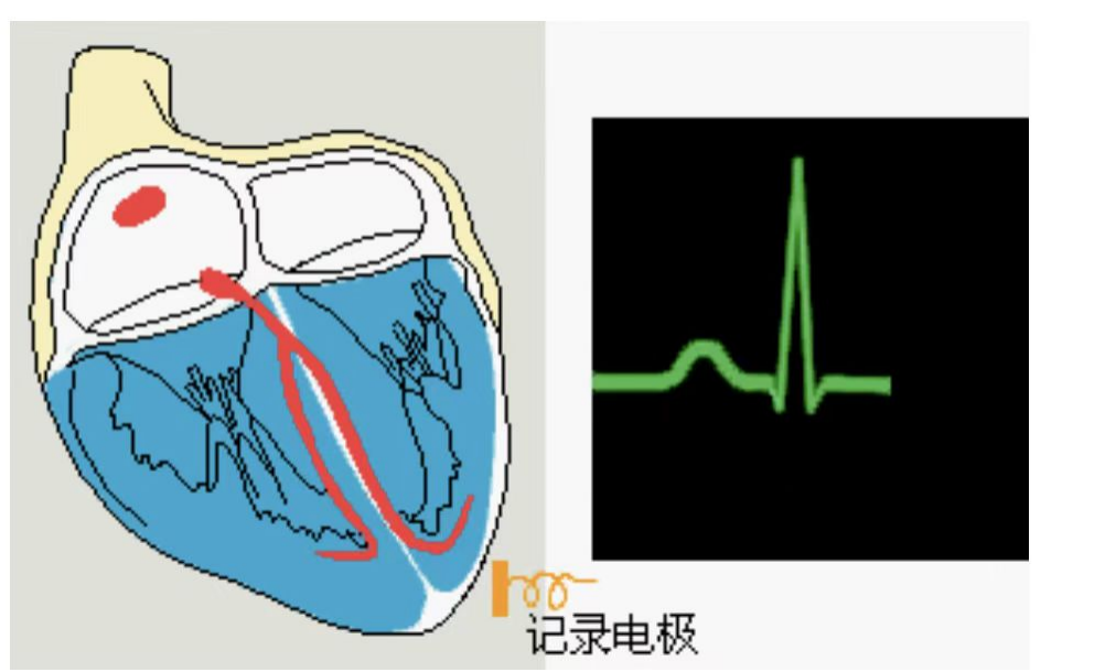 动态心电图仪器怎么看心脏不舒服，心电图显示没问题？动态心电图了解一下_https://www.jmylbn.com_新闻资讯_第7张