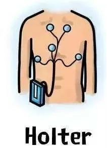 动态心电图仪器怎么看心脏不舒服，心电图显示没问题？动态心电图了解一下_https://www.jmylbn.com_新闻资讯_第3张