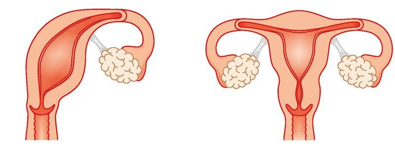 做试管婴儿，为何提倡采用选择性单囊胚移植?