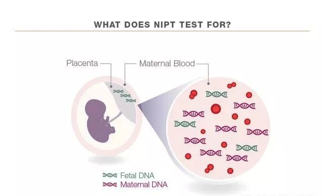 孕期做无创DNA可别胡乱做，搞不清这些问题等于白做！