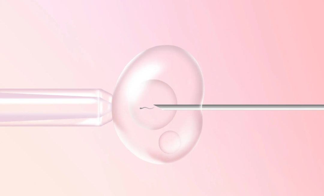 因宫腔粘连导致的孕育困局，该如何破解?