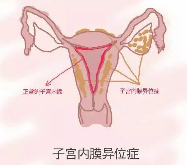 试管知识 | 好“孕”迟到或许和这个因素也有关！