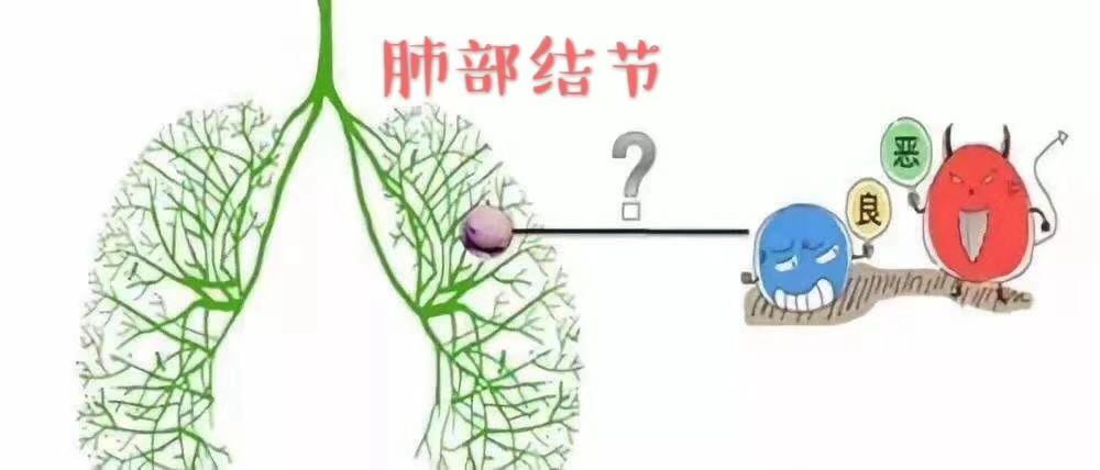 肺部结节 肺部结节