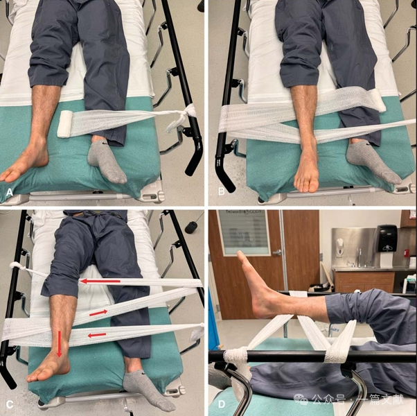 骨折复位技巧：急诊骨折复位的SOLO技术