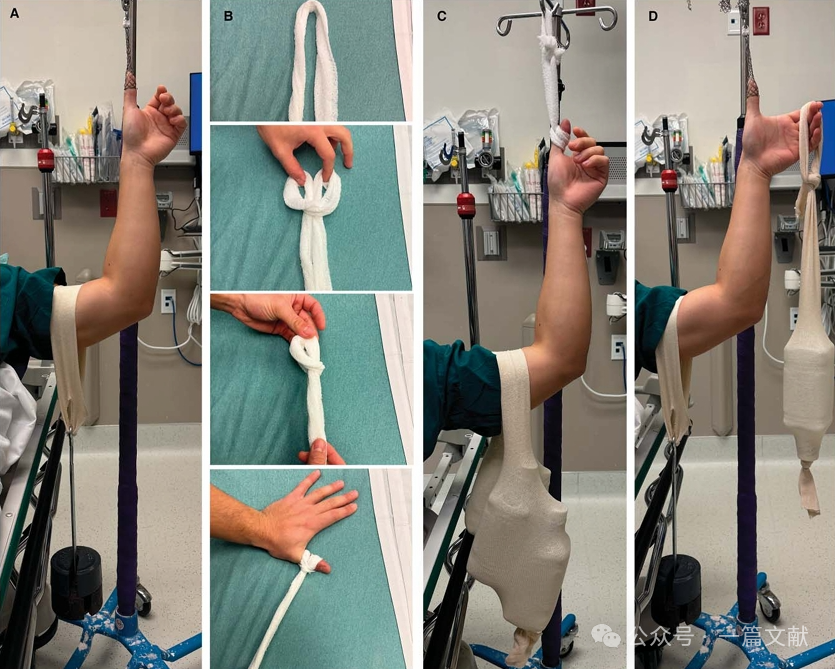 骨折复位技巧：急诊骨折复位的SOLO技术