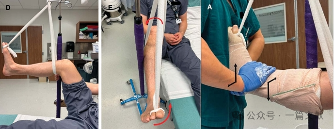 骨折复位技巧：急诊骨折复位的SOLO技术