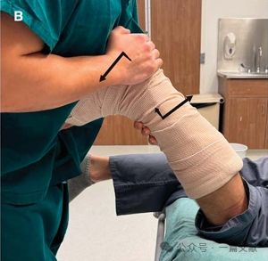 骨折复位技巧：急诊骨折复位的SOLO技术