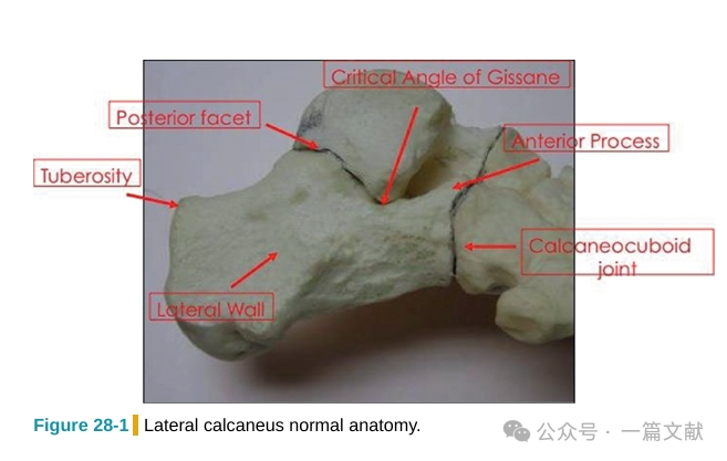 跟骨骨折内固定术中透视技巧