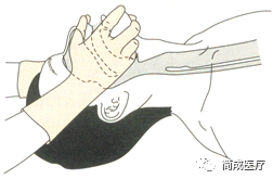 为什么要用喉罩急危重症必备：如何正确使用喉罩？_https://www.jmylbn.com_新闻资讯_第10张