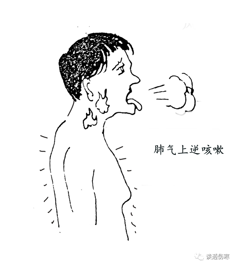 气上逆，就会呕吐。肺气也是以下降为顺。如果肺气上逆，就会造成咳嗽。