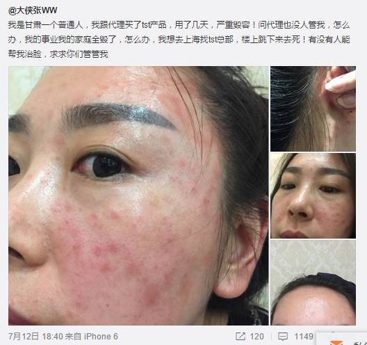 再看看几日前网友崔小姐向全明星探的爆料,她表示"自己使用了演员张庭