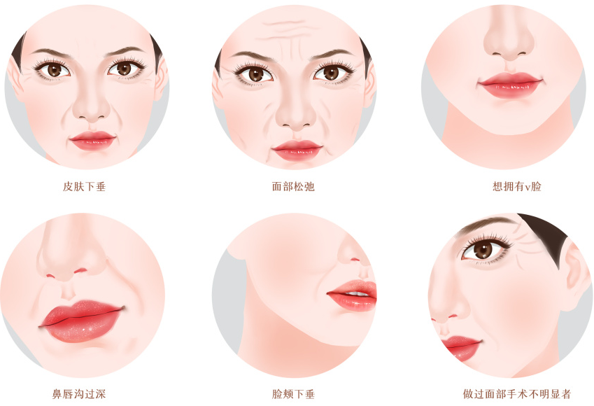 pga和pgla有什么区别早读 ｜ 线雕干货！5大角度深度讲解_https://www.jmylbn.com_新闻资讯_第6张