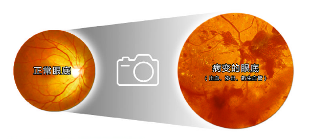 彩色眼底照相查什么拍一张眼底照片，就能帮你查清全身问题！_https://www.jmylbn.com_新闻资讯_第1张