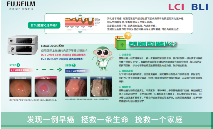 进口胃镜都有哪些品牌内镜中的“福尔摩斯”——日本富士ELUXEO 7000高清电子胃肠镜！_https://www.jmylbn.com_新闻资讯_第15张