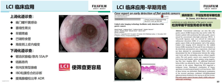 进口胃镜都有哪些品牌内镜中的“福尔摩斯”——日本富士ELUXEO 7000高清电子胃肠镜！_https://www.jmylbn.com_新闻资讯_第14张