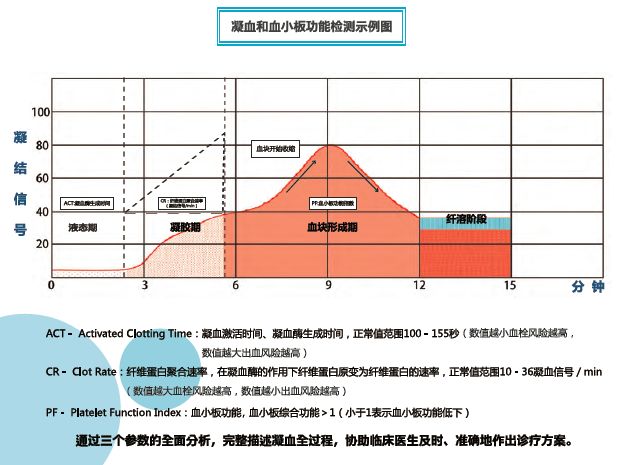 凝血分析仪怎么使用凝血及血小板功能分析仪的原理及应用_https://www.jmylbn.com_新闻资讯_第4张