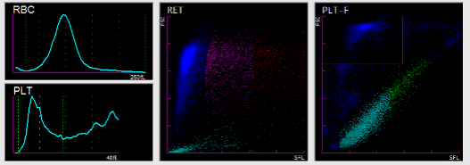 为什么要做尿液分析仪临检常规项目专题 ｜ 血液、尿液常规检验——最熟悉的陌生人_https://www.jmylbn.com_新闻资讯_第2张