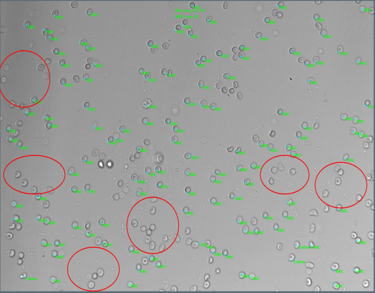 为什么要做尿液分析仪临检常规项目专题 ｜ 血液、尿液常规检验——最熟悉的陌生人_https://www.jmylbn.com_新闻资讯_第4张