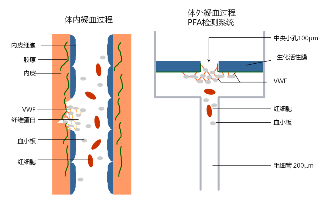 凝血分析仪怎么用凝血与血栓 ｜ 血小板功能检测再添可靠捷径 ----INNOVANCE PFA-200血小板功能分析仪临床应用价值_https://www.jmylbn.com_新闻资讯_第3张