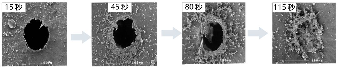 凝血分析仪怎么用凝血与血栓 ｜ 血小板功能检测再添可靠捷径 ----INNOVANCE PFA-200血小板功能分析仪临床应用价值_https://www.jmylbn.com_新闻资讯_第4张