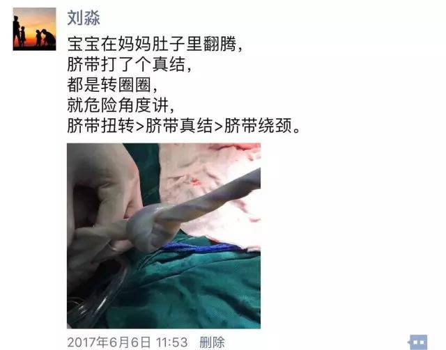 寶寶 38 周沒了心跳，只因沒做好這件事情…… 親子 第8張