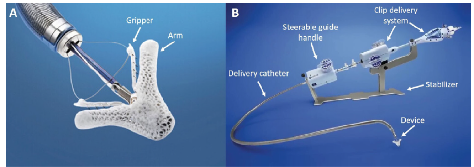 ero为什么不显示经导管二尖瓣修复术：相关病理生理学、研究和治疗综述_https://www.jmylbn.com_新闻资讯_第7张