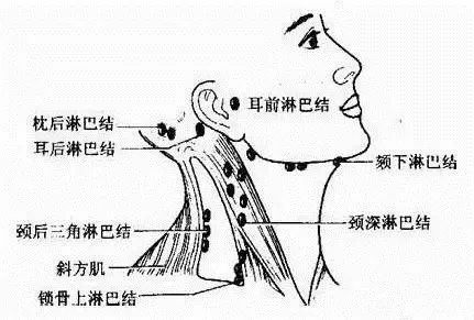 做一次淋巴顶10次消炎点滴