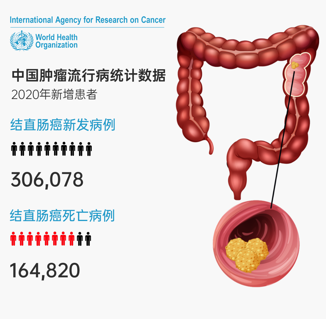 可愈有道_肠癌肝转移
