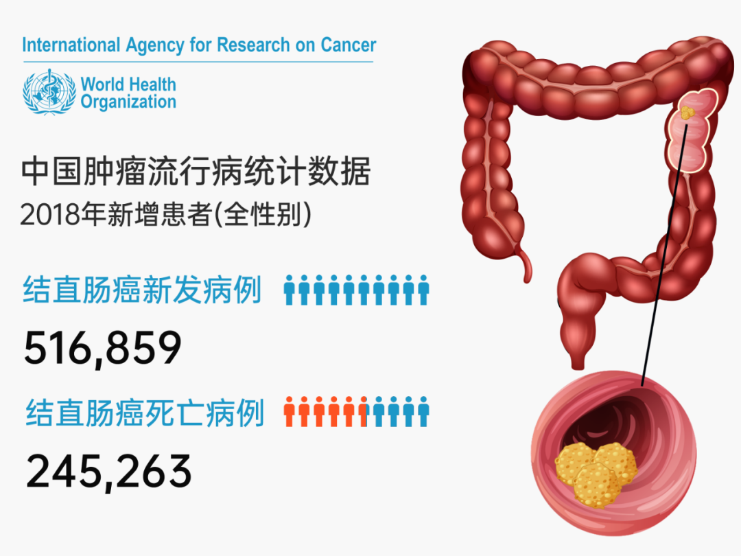 可愈有道_[案例分享]年轻妈妈竟患上IV期结肠癌，癌细胞扩散至肝脏