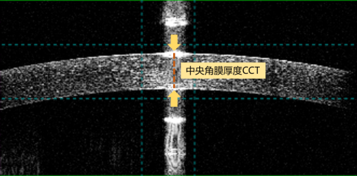 怎么测角膜直径眼视光中心丨一起了解眼球生物学测量_https://www.jmylbn.com_新闻资讯_第17张