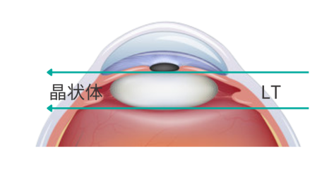 怎么测角膜直径眼视光中心丨一起了解眼球生物学测量_https://www.jmylbn.com_新闻资讯_第19张
