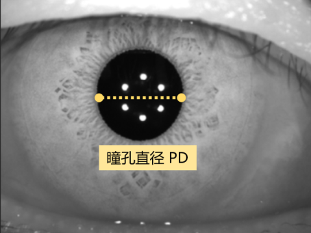 怎么测角膜直径眼视光中心丨一起了解眼球生物学测量_https://www.jmylbn.com_新闻资讯_第15张
