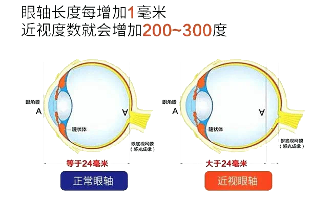 怎么测角膜直径眼视光中心丨一起了解眼球生物学测量_https://www.jmylbn.com_新闻资讯_第13张