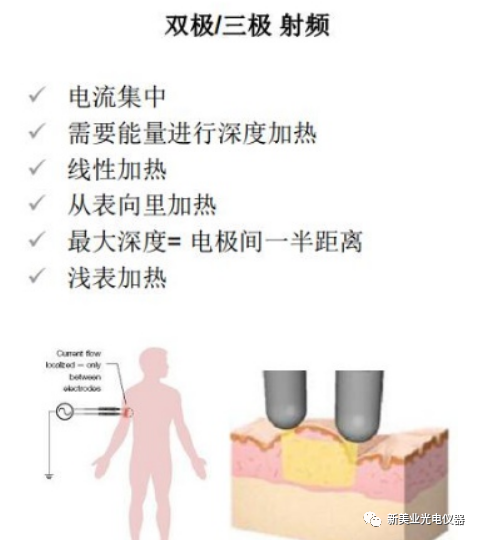 多极射频是什么美容项目射频与热玛吉（一）_https://www.jmylbn.com_新闻资讯_第3张