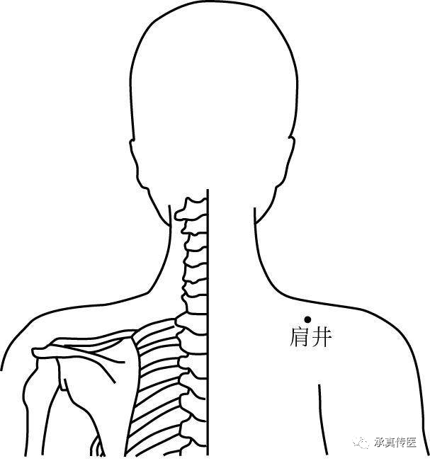 为什么要定位针 乳腺靳三针之乳三针，专治乳腺病。_https://www.jmylbn.com_新闻资讯_第4张