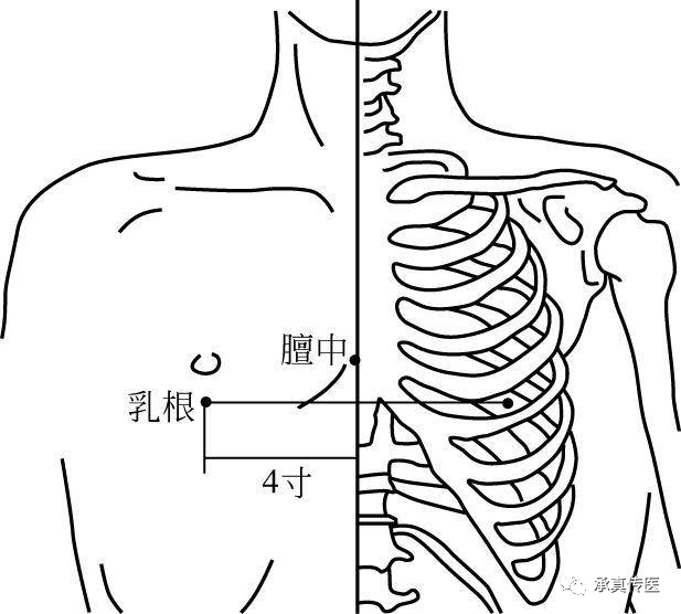 为什么要定位针 乳腺靳三针之乳三针，专治乳腺病。_https://www.jmylbn.com_新闻资讯_第1张