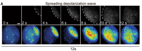 微型化雙光子顯微鏡 自由運(yùn)動 活體成像