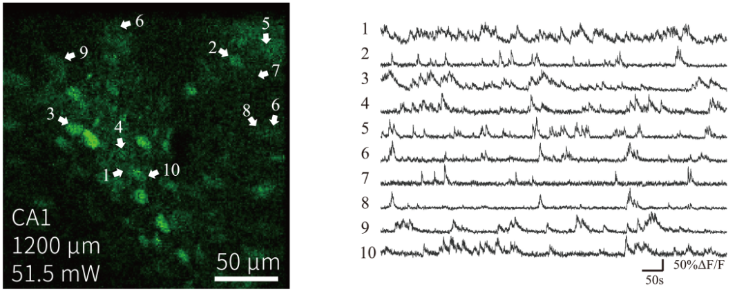 微型化三光子顯微鏡 自由行為動(dòng)物 深腦成像