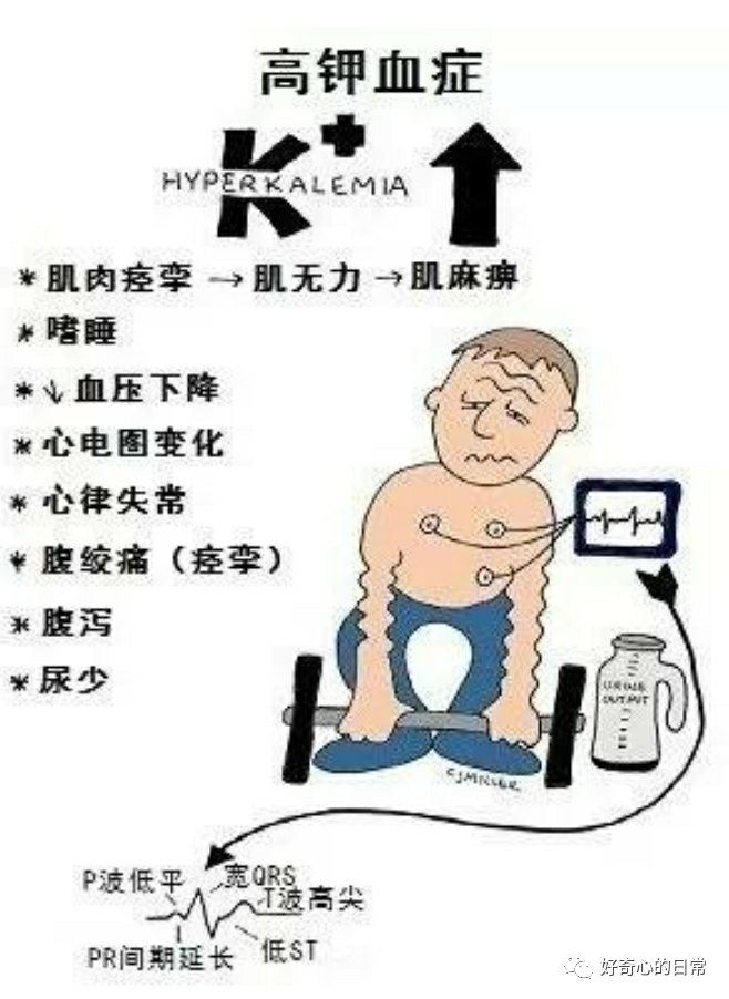 为什么要用推注泵临床基础知识系列（1）-高钾血症的碎碎念_https://www.jmylbn.com_新闻资讯_第1张