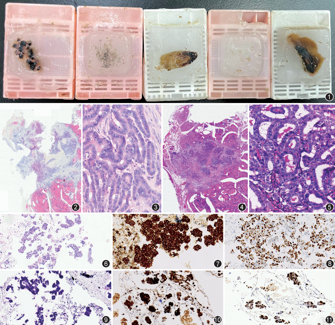 组织块大怎么包埋技术交流 ｜ 洪水浸泡蜡块对病理检测质量影响的观察_https://www.jmylbn.com_新闻资讯_第3张