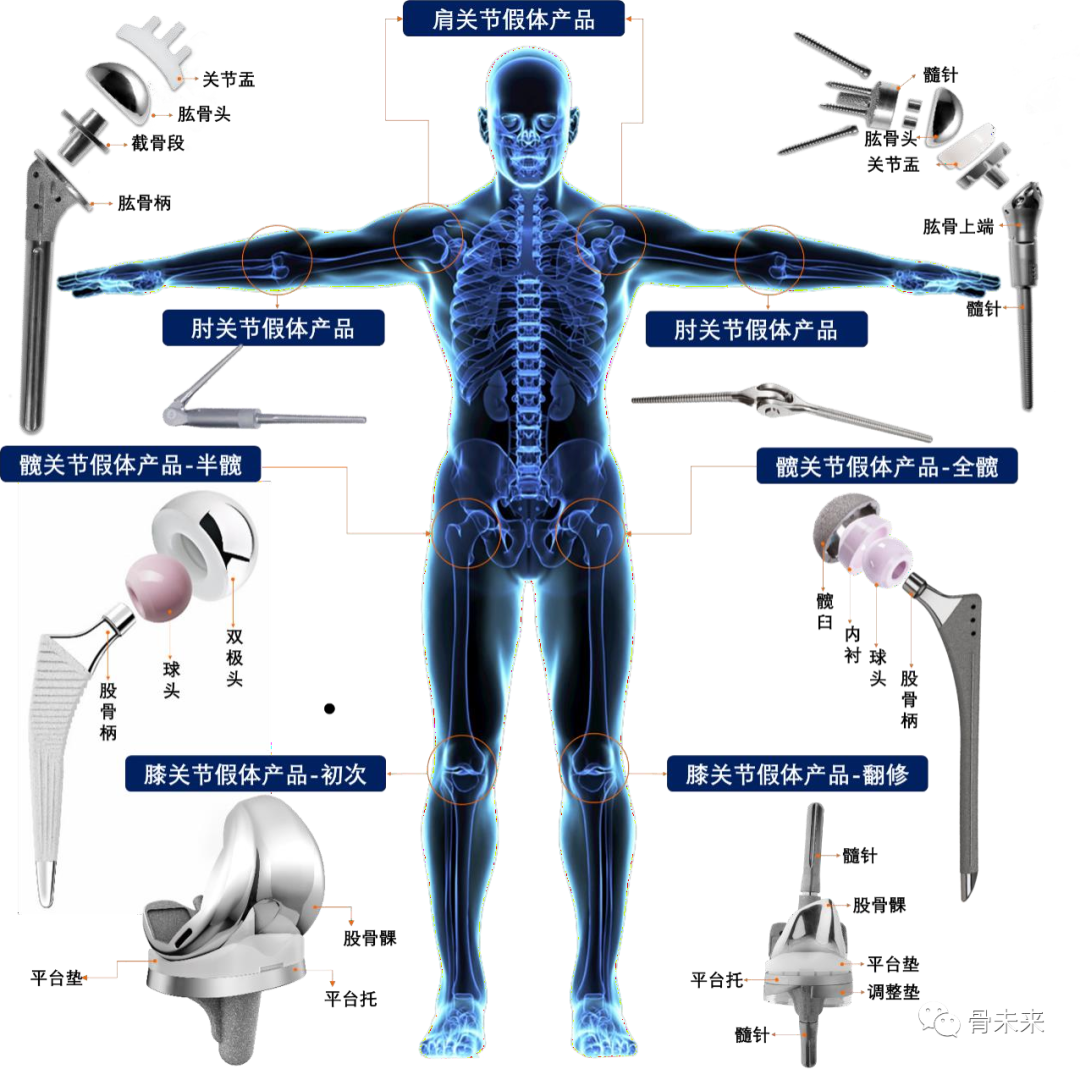 医疗器械两票制怎么办收入5.71亿，增长18%，骨科公司春立医疗发布半年报_https://www.jmylbn.com_新闻资讯_第4张