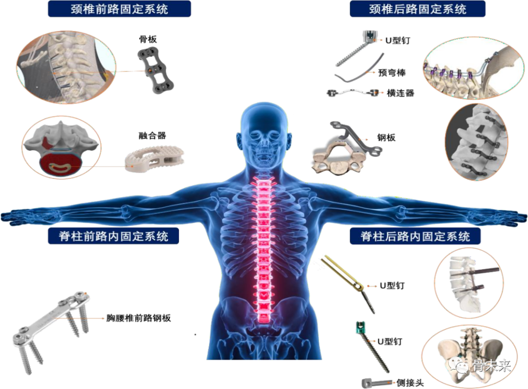医疗器械两票制怎么办收入5.71亿，增长18%，骨科公司春立医疗发布半年报_https://www.jmylbn.com_新闻资讯_第5张