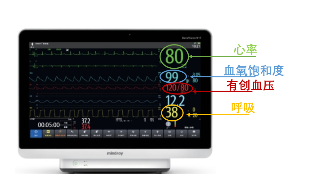 生命体征监测仪怎么看监护仪上的数字都代表什么？一文教你看懂患者生命体征_https://www.jmylbn.com_新闻资讯_第5张