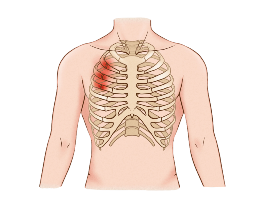 肋骨图片位置图图片