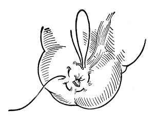 医疗缝线怎么做外科常见缝合方法_https://www.jmylbn.com_新闻资讯_第11张