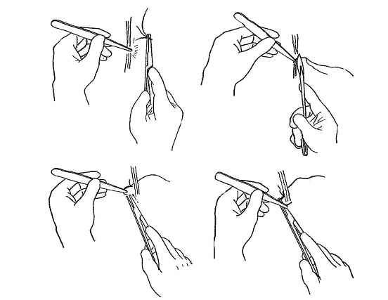 医疗缝线怎么做外科常见缝合方法_https://www.jmylbn.com_新闻资讯_第2张