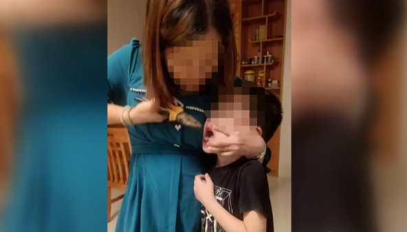 医用钳子怎么拿钳子拔牙、乳牙龋齿……医生：别拿乳牙不当牙，这份护牙“秘笈”请收好~_https://www.jmylbn.com_新闻资讯_第17张