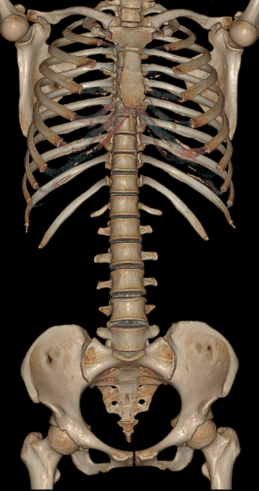联影ct怎么样科技助力健康丨“全球顶尖超高端”联影天河640层CT启用“满百天”_https://www.jmylbn.com_新闻资讯_第15张